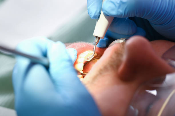 Best Broken or Cracked Tooth Emergency Dentist in Douglas, WY